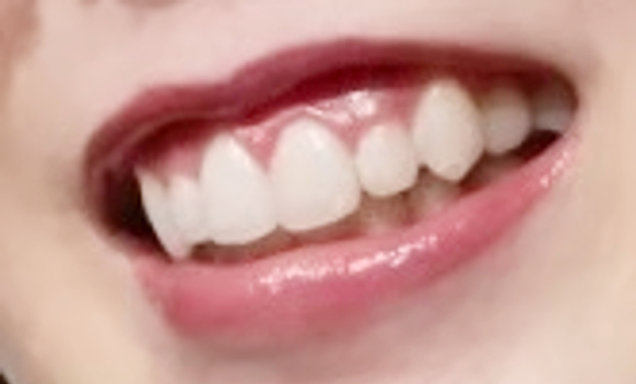 Oral5-4【ヴォリュプテ】